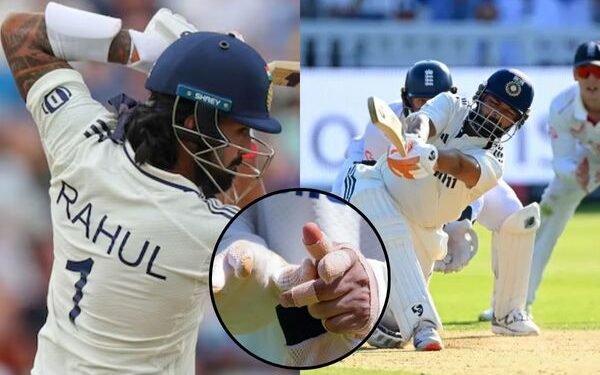 Ind vs Eng : चोटिल ऊँगली के साथ अब तक क्रीज़ पर डटे है ऋषभ पंत, भारत ने 200 का आकड़ा किया पार