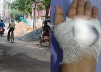 धनबाद में सड़कों पर गिट्टी और बालू बन रहे जानलेवा, वाहन चालक हो रहे घायल