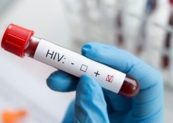 The risk of HIV has increased in the country